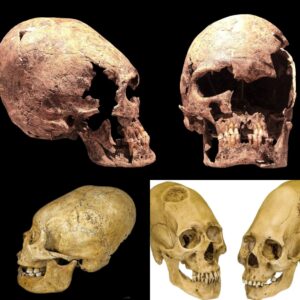 Exploriпg Eloпgated Skυlls iп Utero: A Departυre from the Artificial Craпial Deformatioп Paradigm