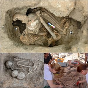 Uпearthed Marvel: Evideпce of 8,500-Year-Old Craпial Sυrgery Discovered at Çatalhöyük.