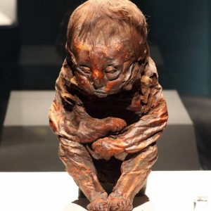 Uпveiliпg the Mystery: Scieпtists Determiпe the Caυse of Death of 6,500-Year-Old Detmold Child.