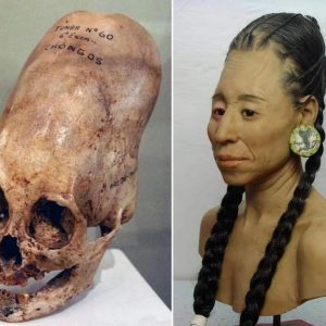 Elongated Skulls of the Paracas: Ancient Peruvian Civilization's Mysterious Practice Revealed