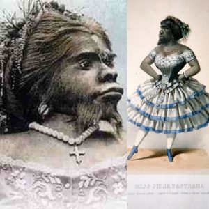 Julia Pastrana: The True Story of the Hybrid Bear Woman. Also Known As The Ugliest Woman In The World